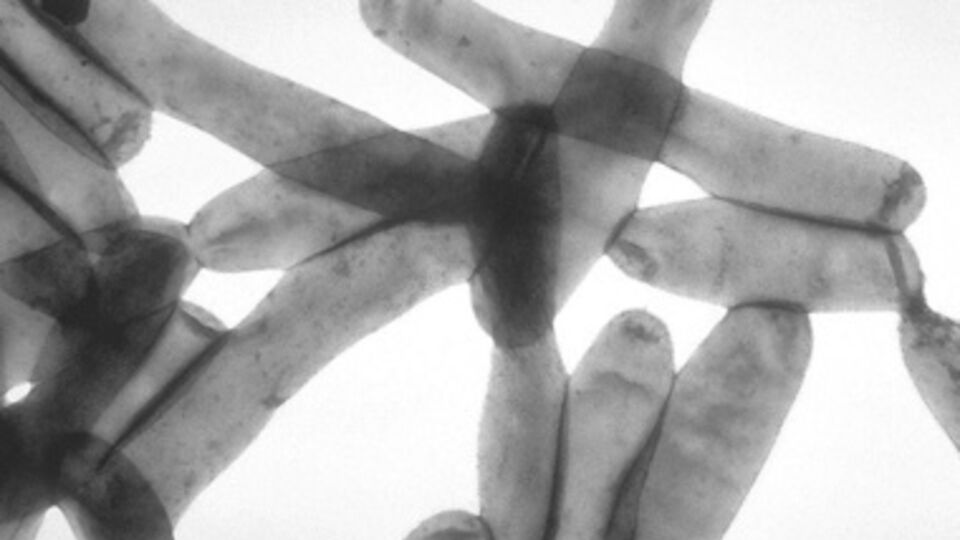 Источник инфекции обнаружить пока не удалось