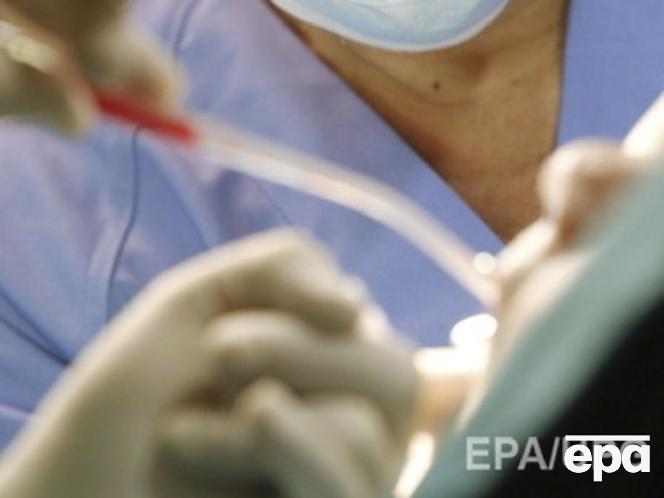 Ученые исследовали здоровье ротовой полости разных слоев общества