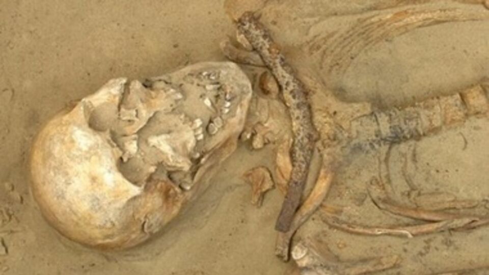 В Средневековье ранние случаи холеры принимали за проявления вампиризма