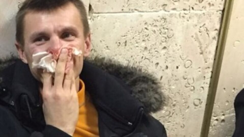 По данным МВД, Коба трижды не явился на вызов следователя