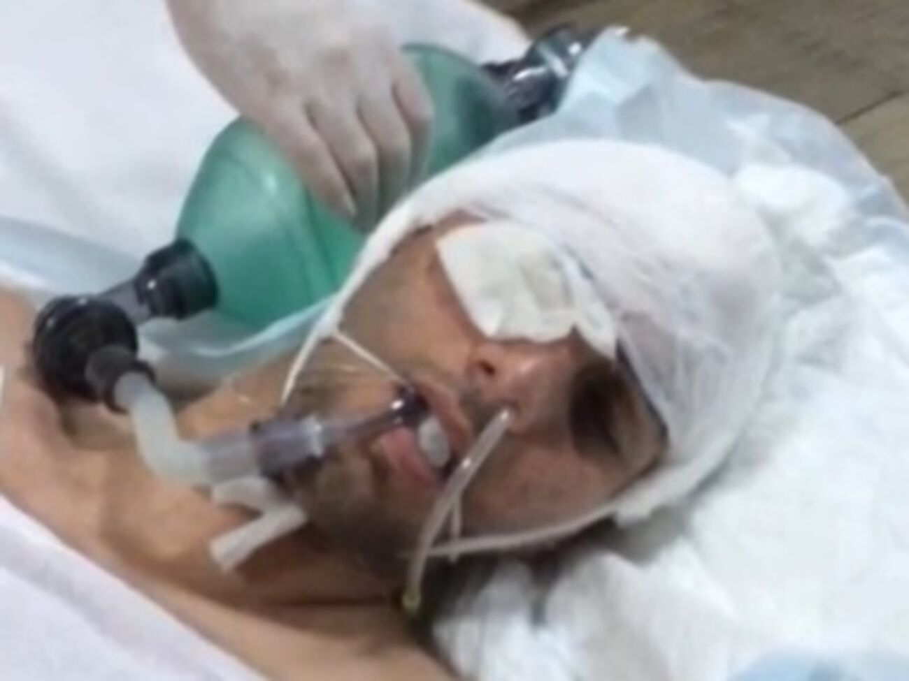 Магомед Алиев находится в больнице с 27 ноября