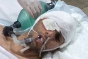 Магомед Алиев находится в больнице с 27 ноября