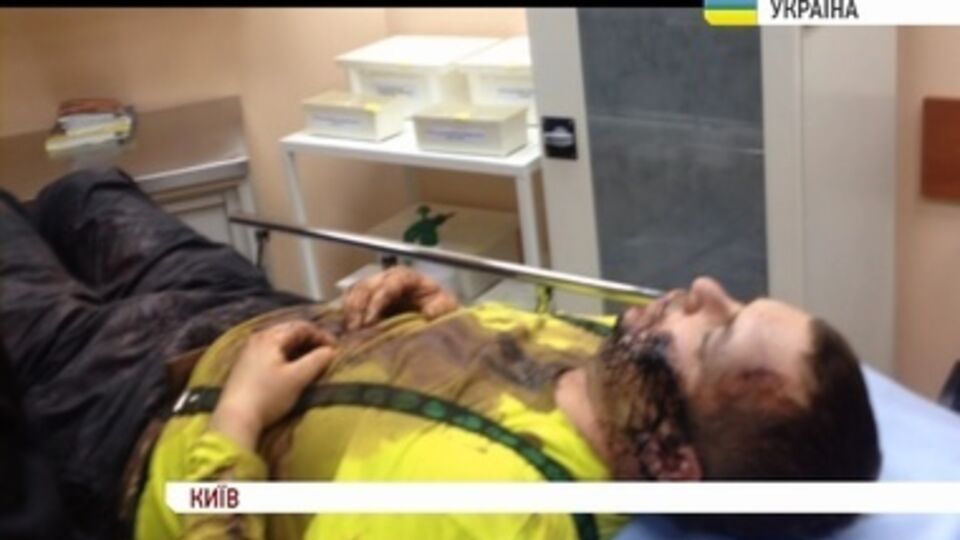 Булатов и его "царапина"