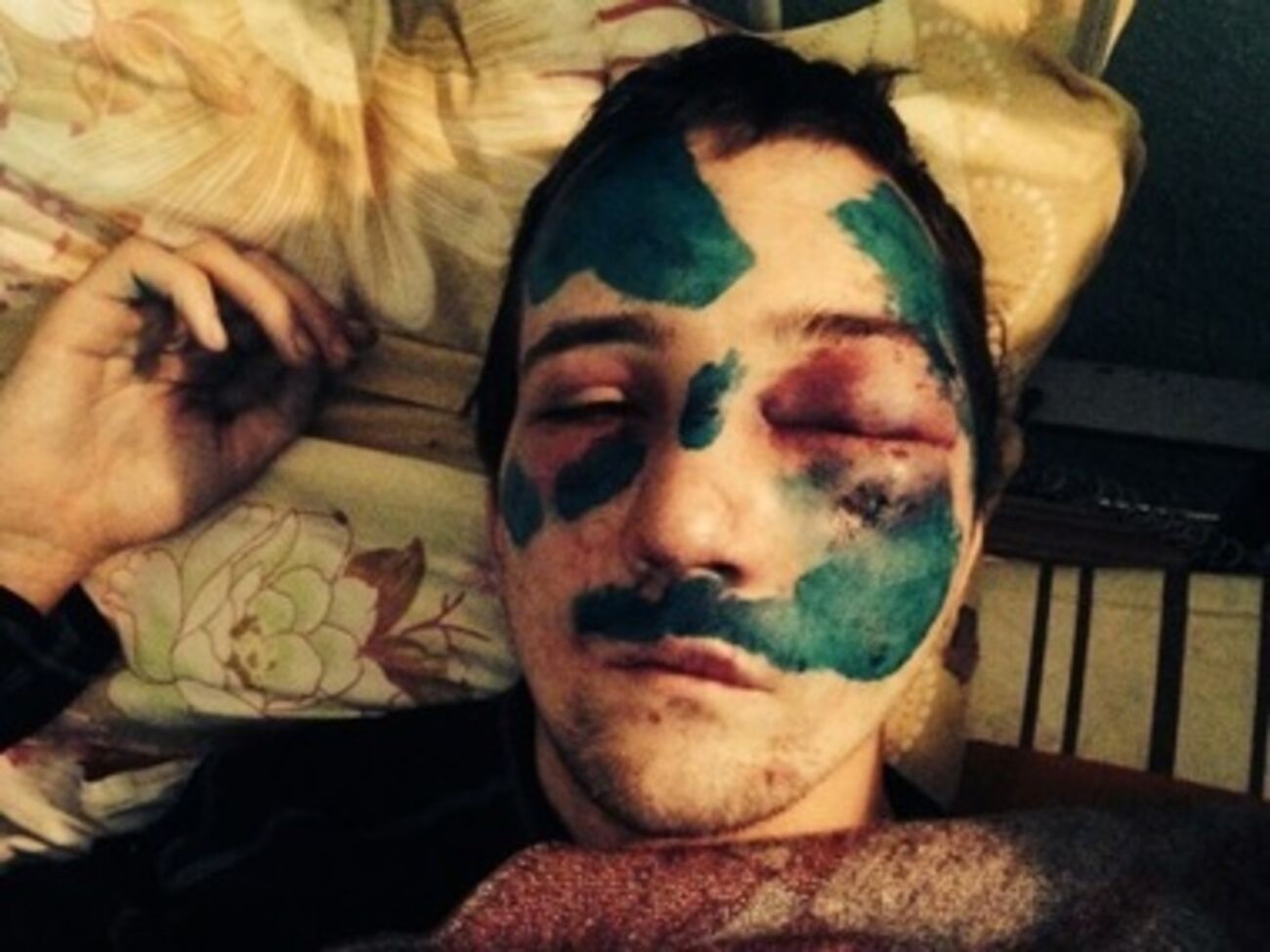 Активист через несколько дней после задержания