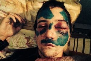 Активист через несколько дней после задержания