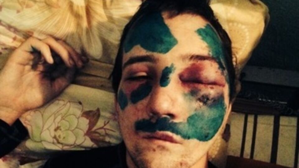 Активист через несколько дней после задержания