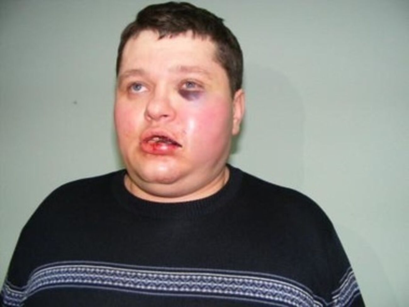 При задержании Смалия избили милиционеры, находившиеся в зале суда