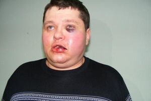 При задержании Смалия избили милиционеры, находившиеся в зале суда