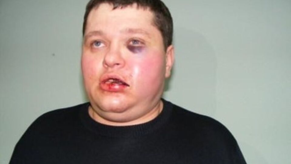 При задержании Смалия избили милиционеры, находившиеся в зале суда