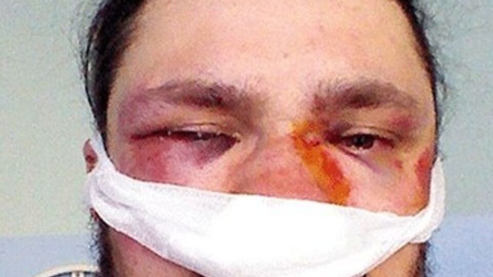 Украинские журналисты получили ранения в стычках с правоохранителями