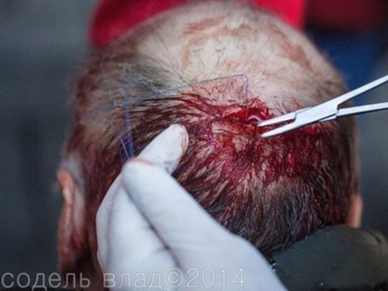 Избитый киевлянин