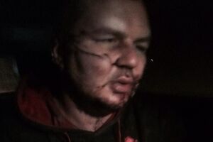 Дмитрий Булатов после недели пыток