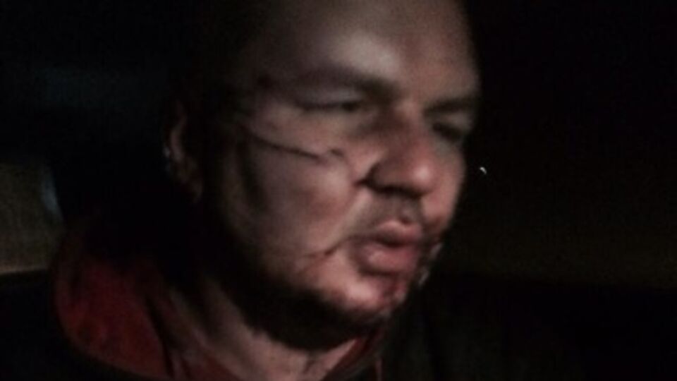 Дмитрий Булатов после недели пыток