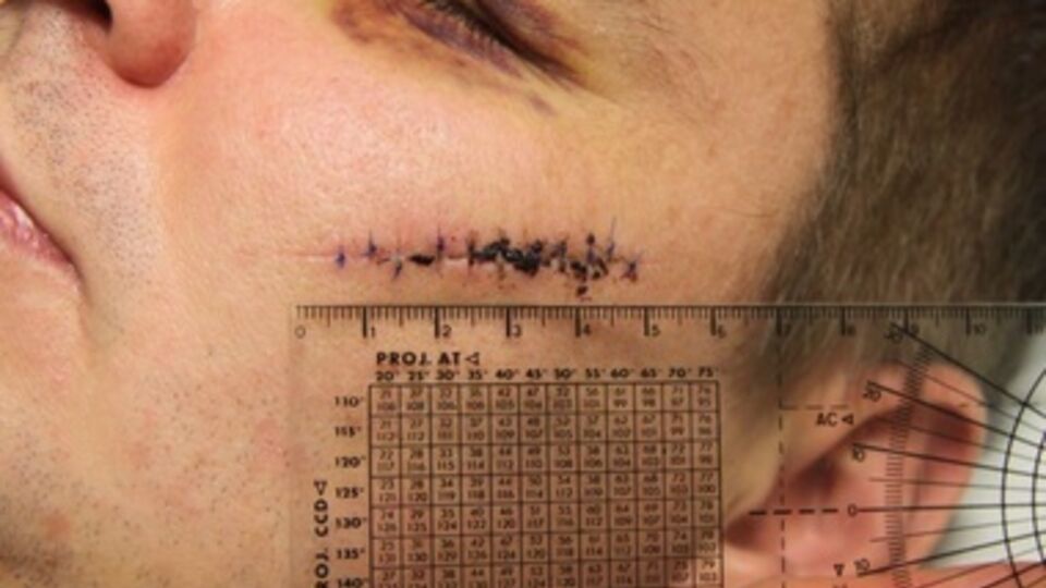 Врачи показали фото ранений лидера Автомайдана Булатова