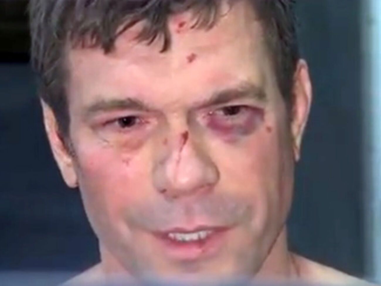 Олег Царев после ночного нападения