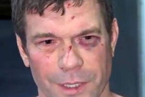 Олег Царев после ночного нападения