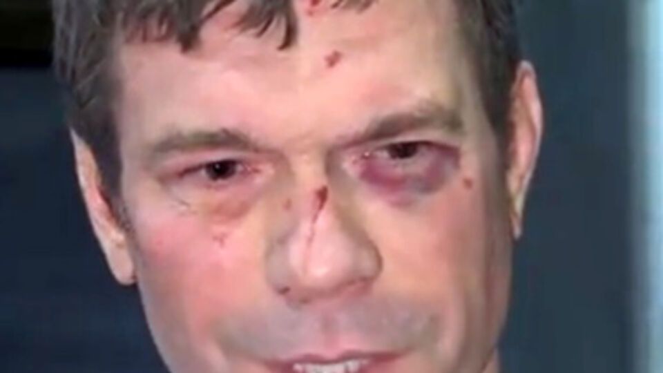 Олег Царев после ночного нападения