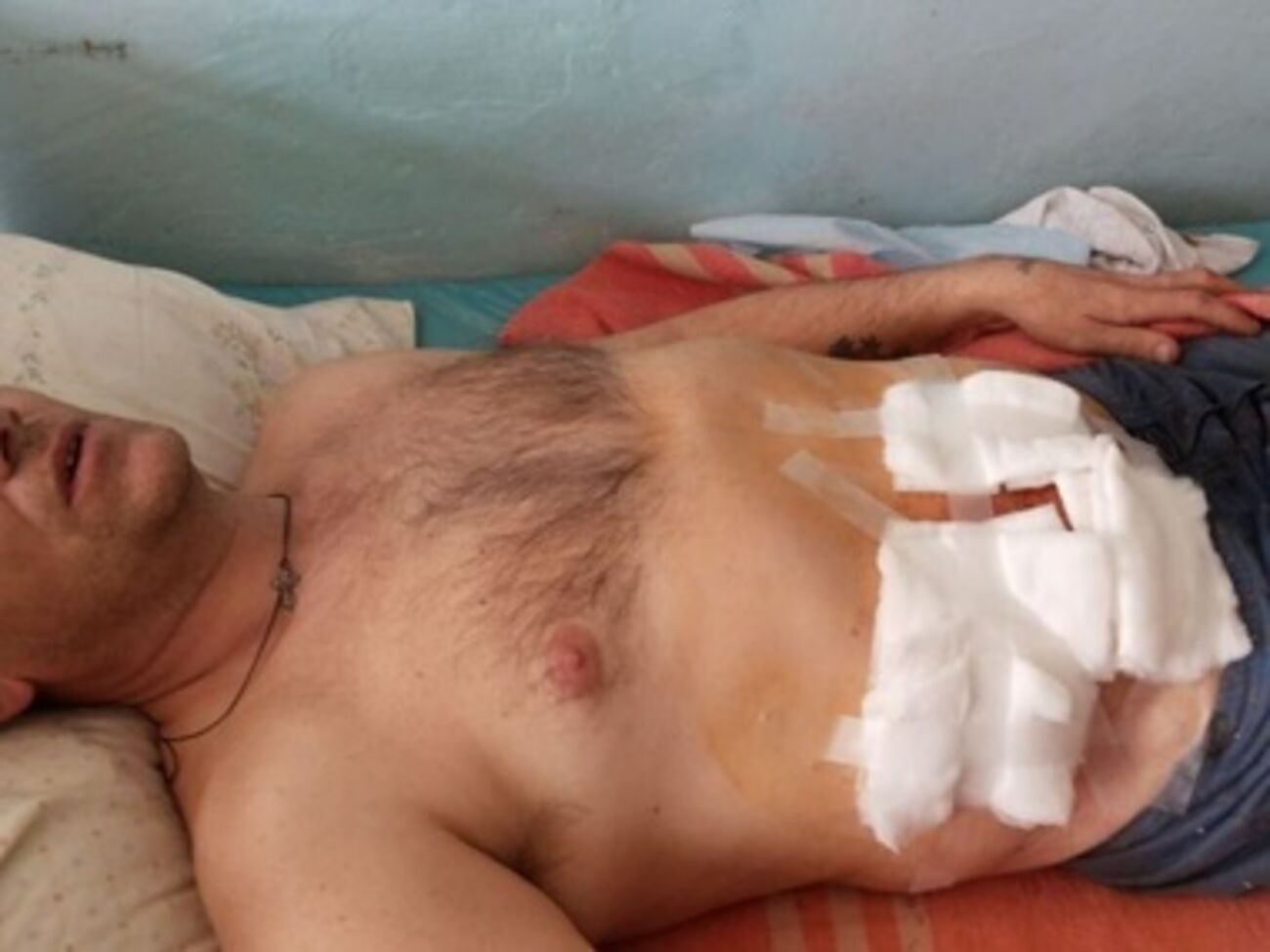 Мариуполец, получивший во время штурма военной части ранение в живот, опасается мести "киевской хунты"