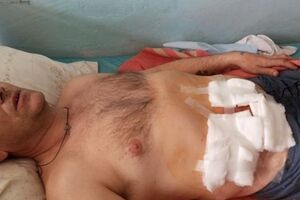 Мариуполец, получивший во время штурма военной части ранение в живот, опасается мести "киевской хунты"