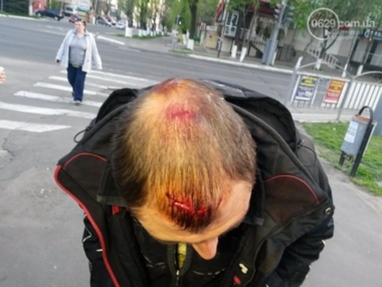 Один из пострадавших в ходе ночных столкновений