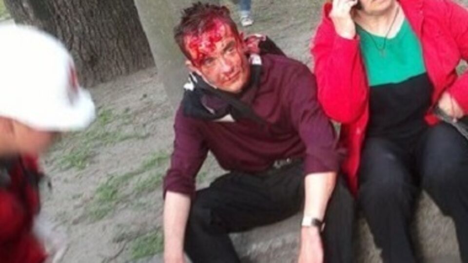 В результате столкновений между футбольными фанатами и сепаратистами есть пострадавшие