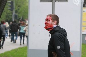 Нескольким избитым пришлось обратиться в больницы