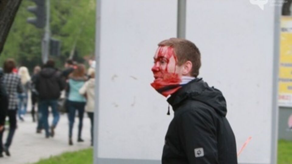 Нескольким избитым пришлось обратиться в больницы