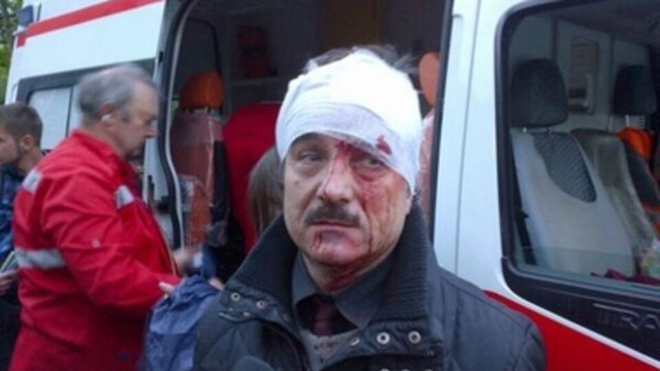 Один из пострадавших на митинге