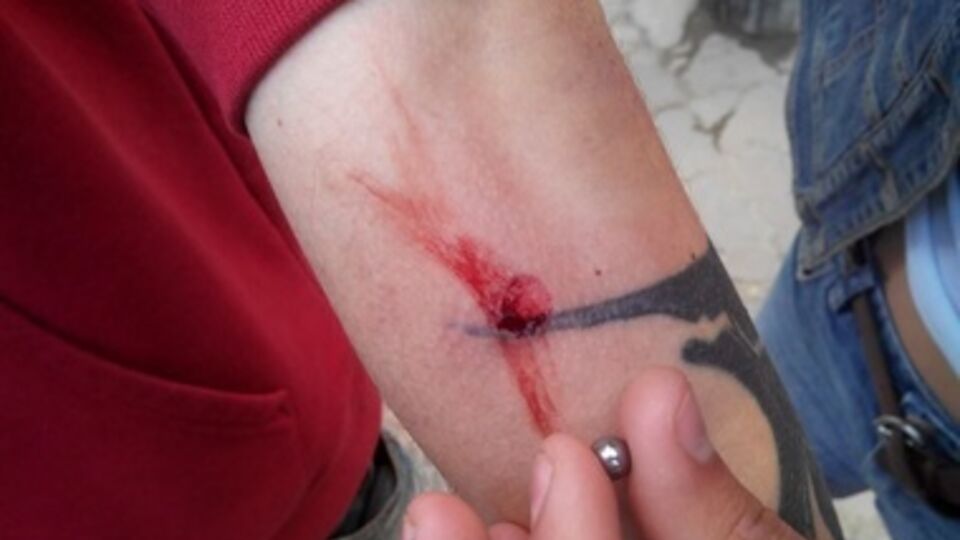 Столкновения между сепаратистами и сторонниками Майдана в Одессе. Фоторепортаж