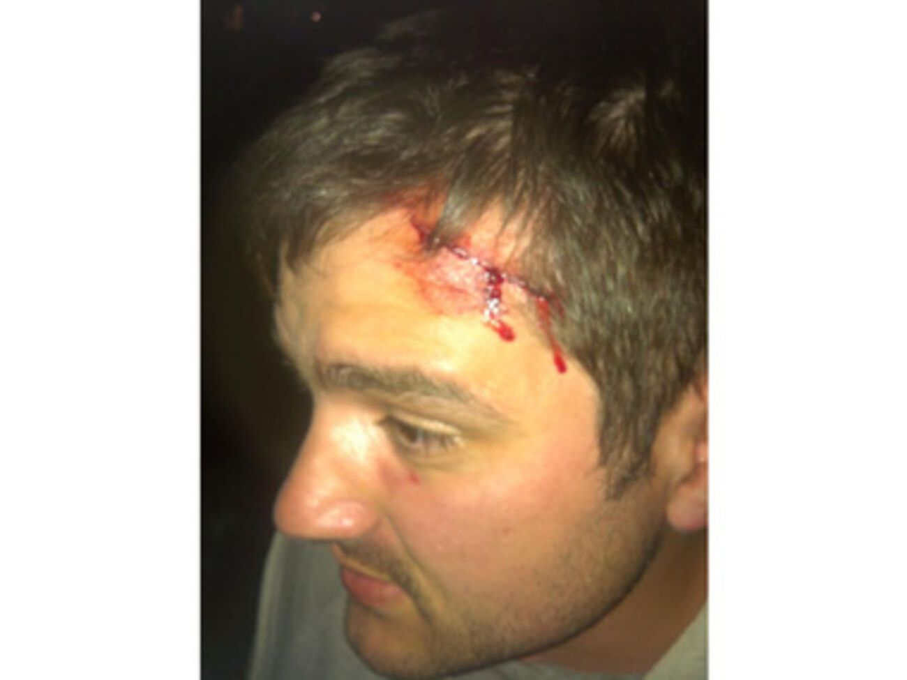 Избитый кандидат от "Свободы" Руслан Андрейко