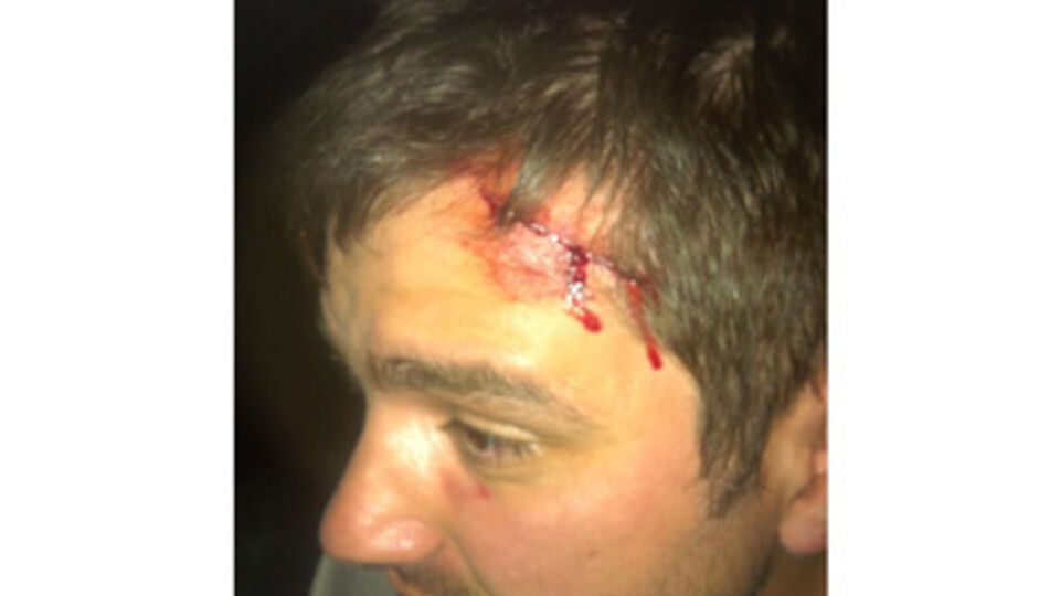 Избитый кандидат от "Свободы" Руслан Андрейко