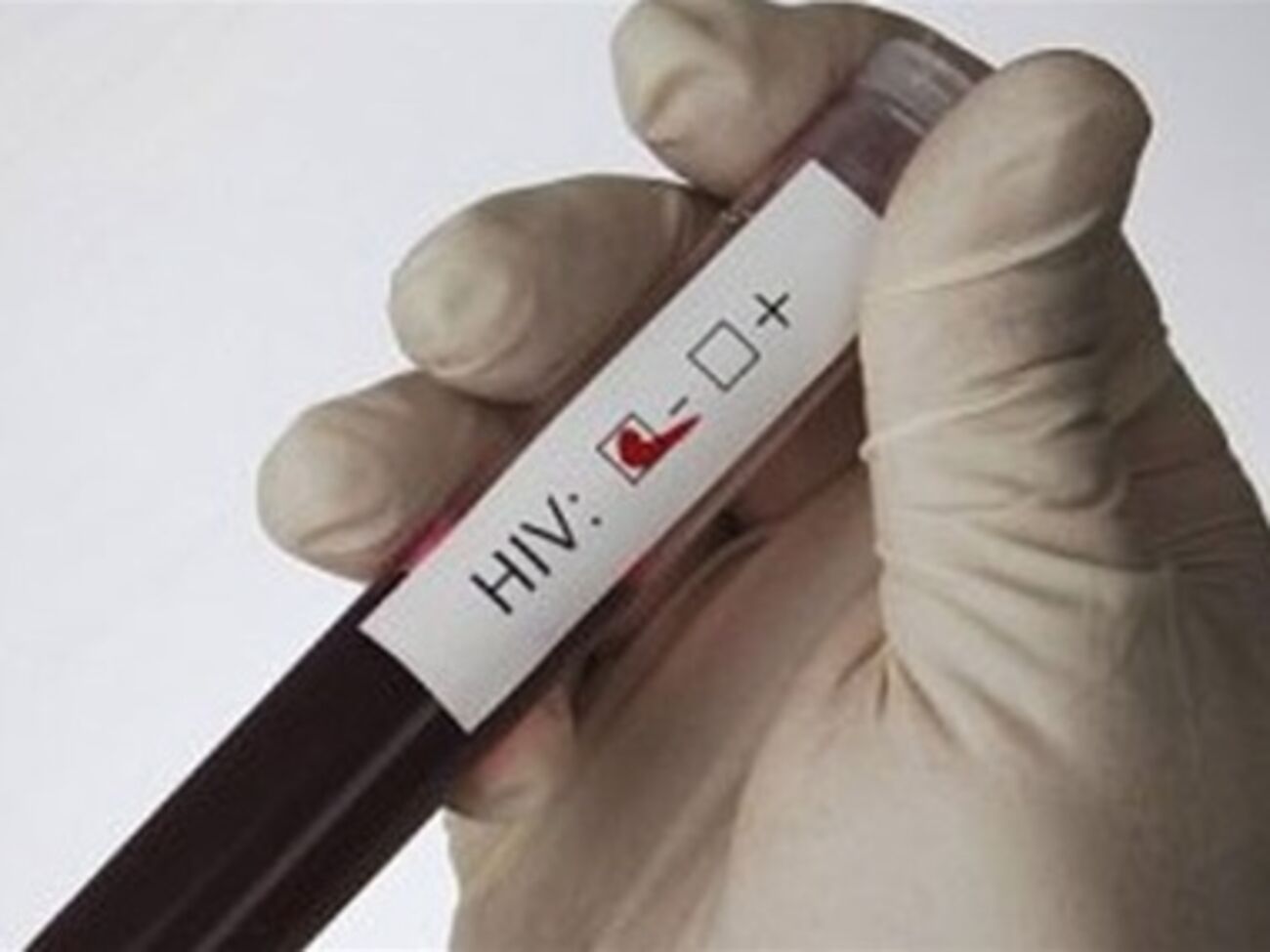 Кроме тестирования на антитела к ВИЧ, участники акции смогут получить информационно-консультативные услуги