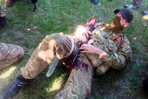 Один из раненых в Донецке террористов