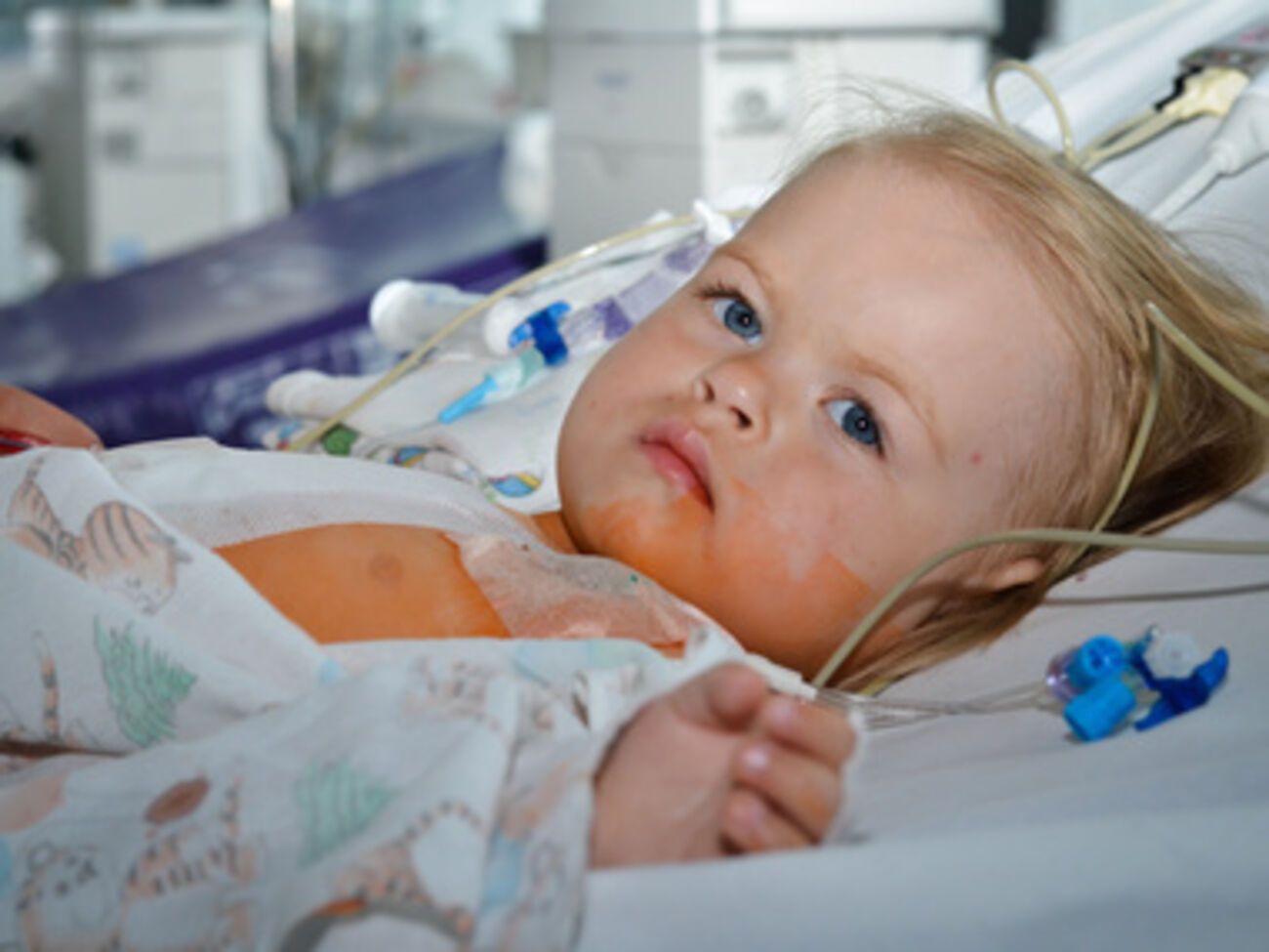 Маленькой пациентке&nbsp;Лизе 1 год и 2 месяца