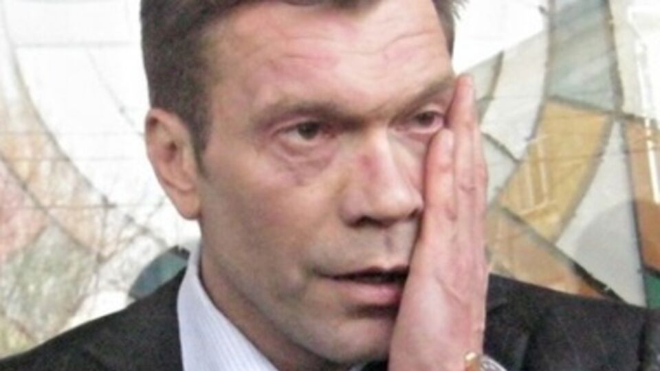 Олег Царев показал сгоревшие маршрутки своего помощника