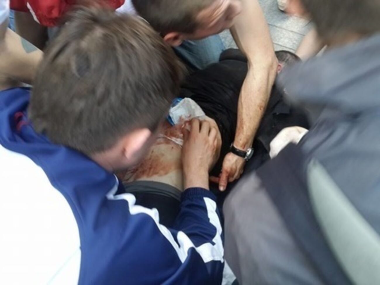 Оказание помощи пострадавшему во время беспорядков 2 мая в Одессе