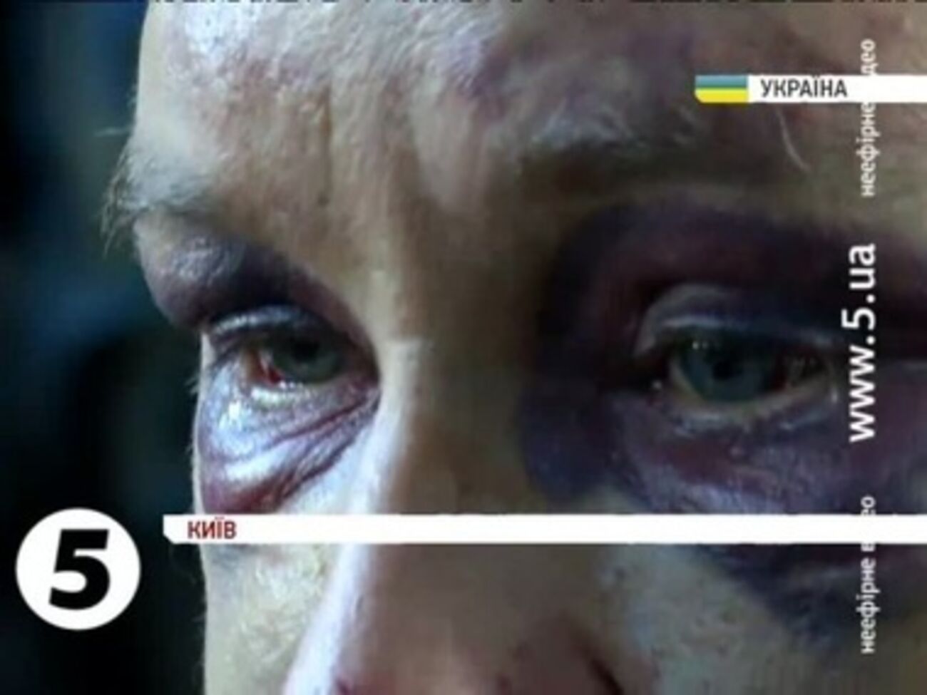 Заложники в Новогродовке подвергались пыткам