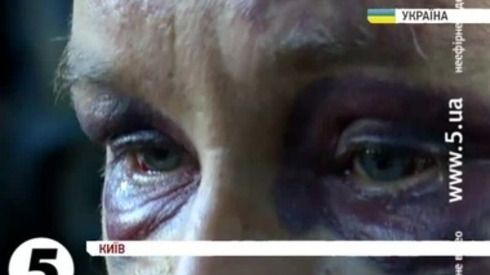 Заложники в Новогродовке подвергались пыткам