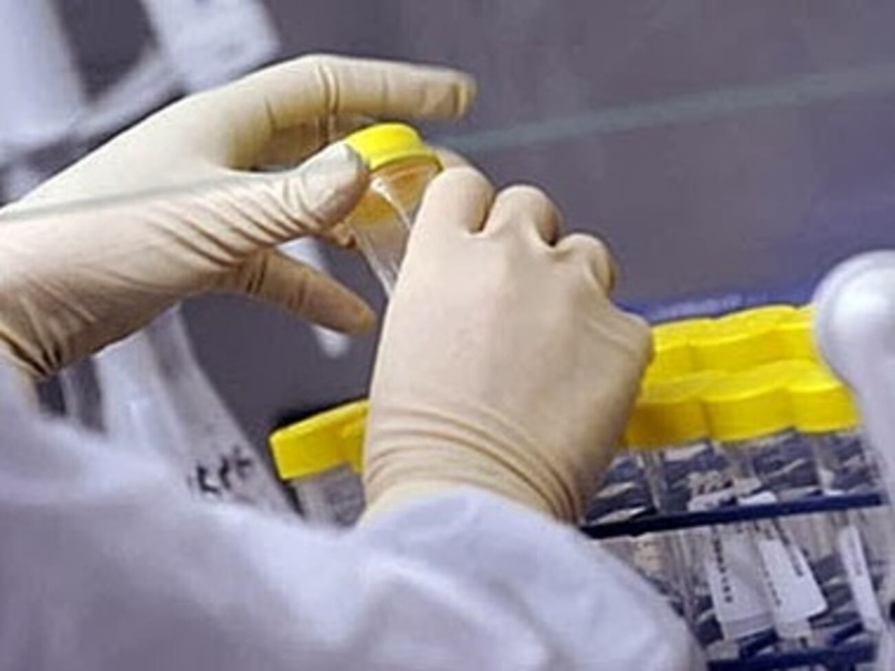 В Санэпидслужбе пообещали отреагировать на ситуацию с незаконными захоронениями