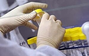 В Санэпидслужбе пообещали отреагировать на ситуацию с незаконными захоронениями