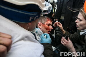 МВД закупило в РФ гранаты с химическими и взрывчатыми компонентами