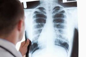 Украинские врачи стараются не говорить о туберкулезе. Некоторые из них считают, что приближается катастрофа