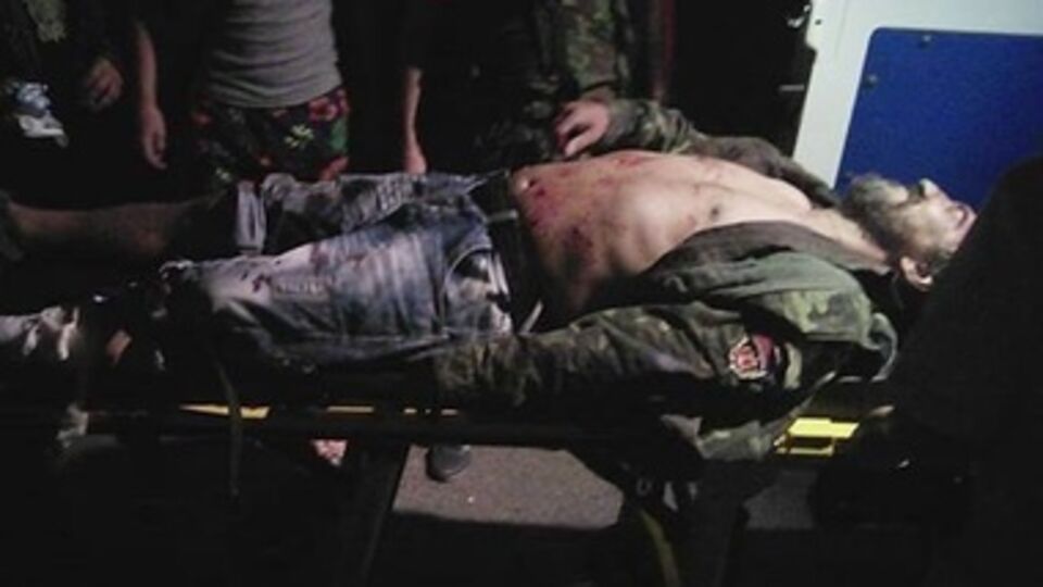 Раненного мужчину забрали медики