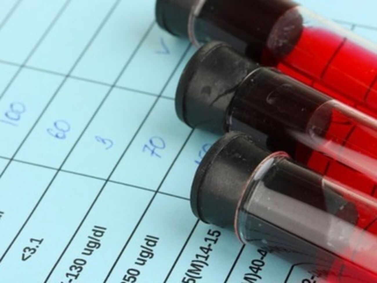 Разработан тест, который может помочь в борьбе с болезнью Альцгеймера