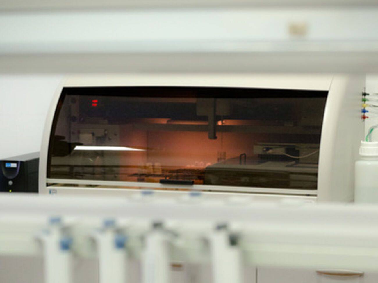 В ближайшее время такой же анализатор будет передан в Харьковский военный госпиталь