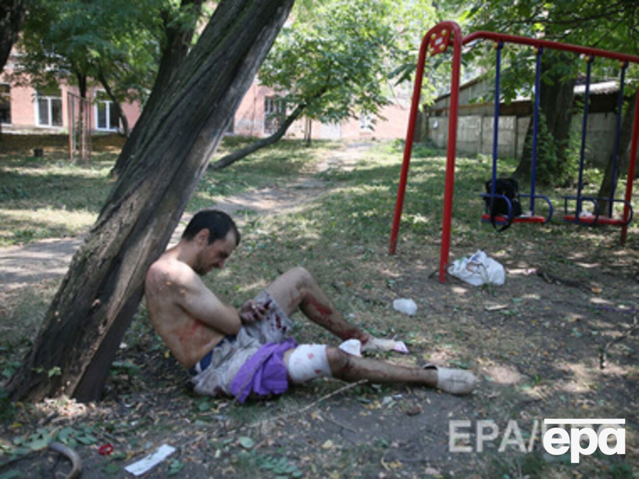 Один из раненых 14 августа жителей Донецка