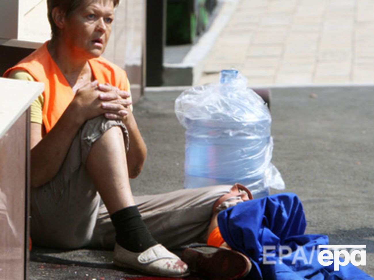 Одна из раненых 7 августа жительниц Донецка