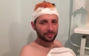 Филатов: Сейчас у Парасюка все хорошо