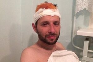 Филатов: Сейчас у Парасюка все хорошо
