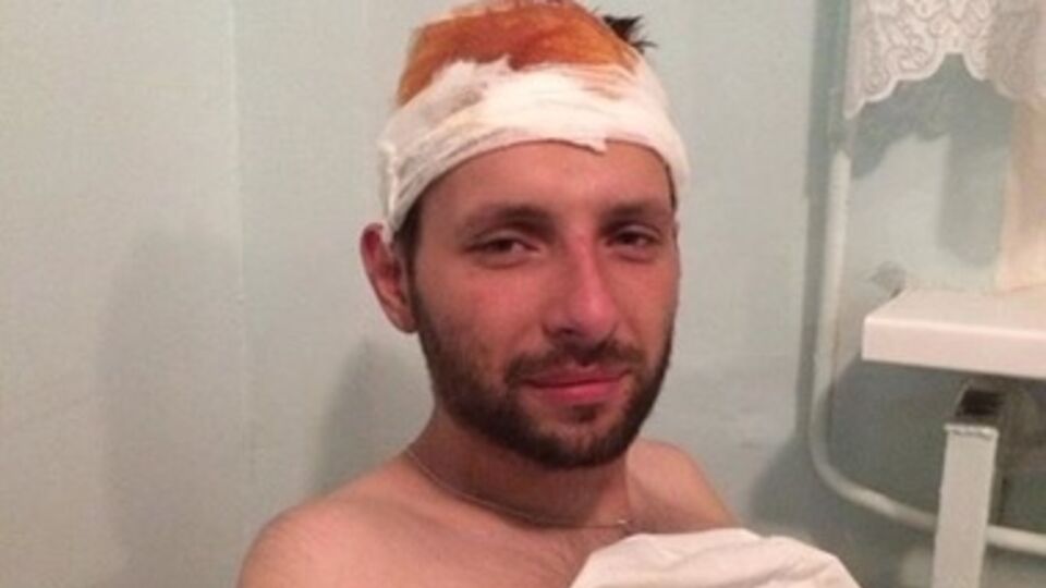 Филатов: Сейчас у Парасюка все хорошо